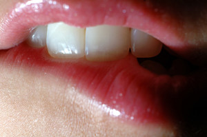 Si Tengo VPH Oral, ¿Seguro Voy a Tener Cáncer Oral?